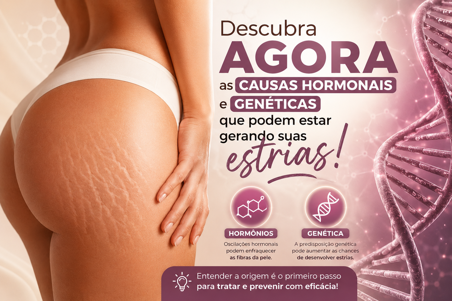 Descubra Agora as Causas Hormonais e Genéticas que Podem Estar Gerando Suas Estrias!